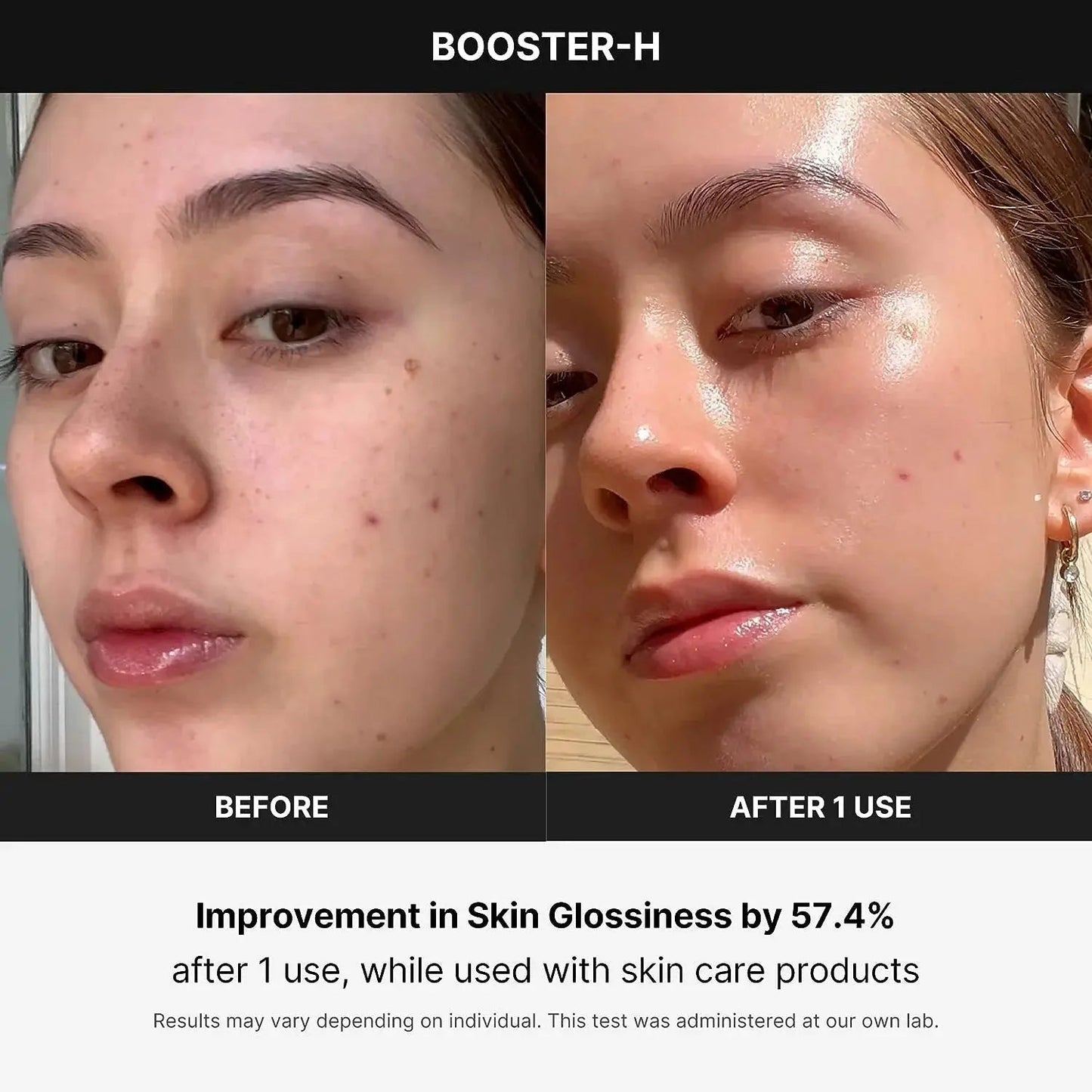 Age - R Booster Healer – Korean Facial Treatment Device for Deep Hydration, Skin Rejuvenation & Natural Glow - RELUX.STORE