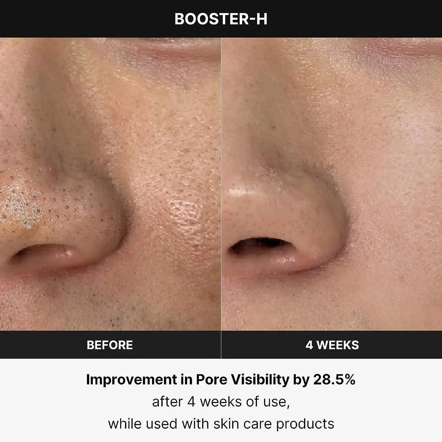 Age - R Booster Healer – Korean Facial Treatment Device for Deep Hydration, Skin Rejuvenation & Natural Glow - RELUX.STORE
