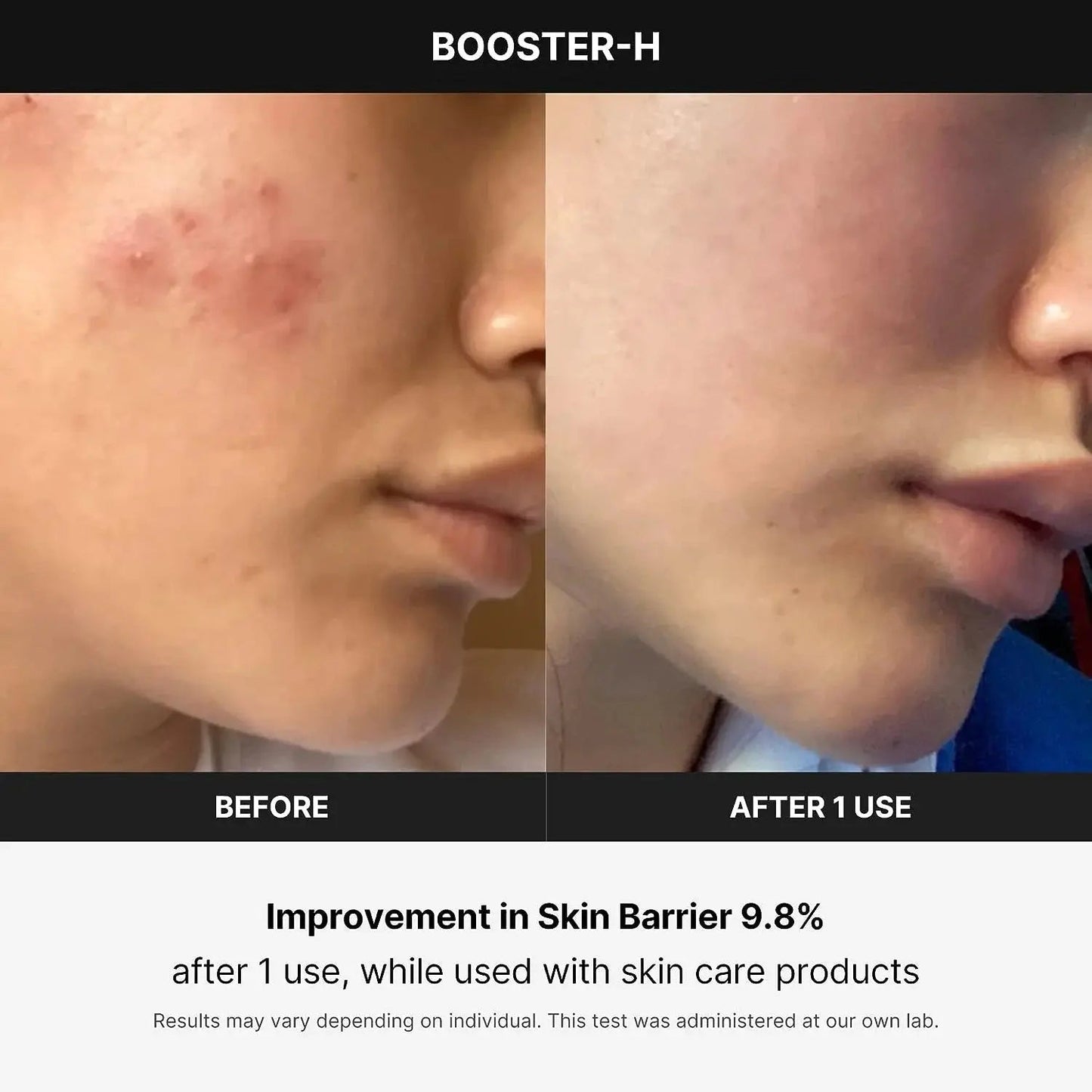 Age - R Booster Healer – Korean Facial Treatment Device for Deep Hydration, Skin Rejuvenation & Natural Glow - RELUX.STORE