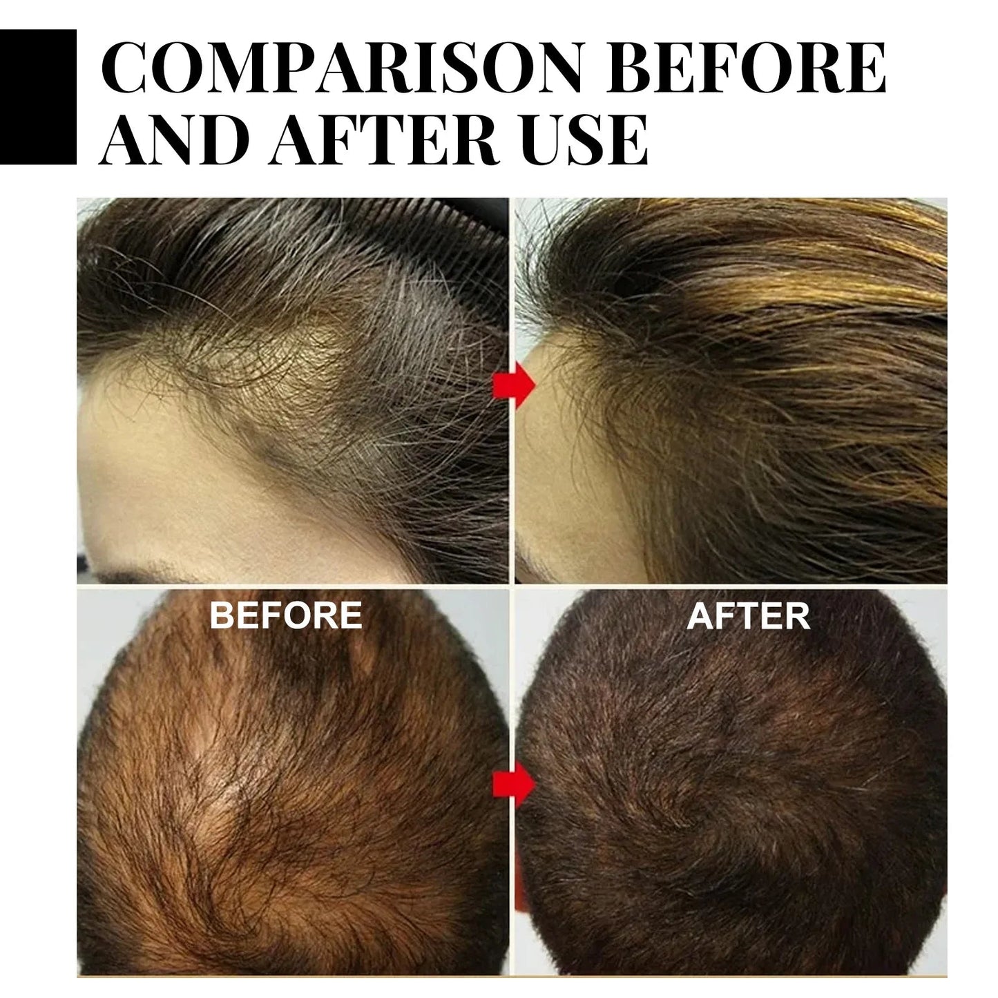 Fast Hair Growth Set Batana Oil Traction Alopecia Hair Mask Anti Break Loss Hair Growth Oil Baldness Treatment Hair Health Care - RELUX.STORE