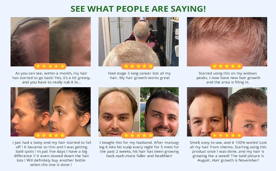 Fast Hair Growth Set Batana Oil Traction Alopecia Hair Mask Anti Break Loss Hair Growth Oil Baldness Treatment Hair Health Care - RELUX.STORE