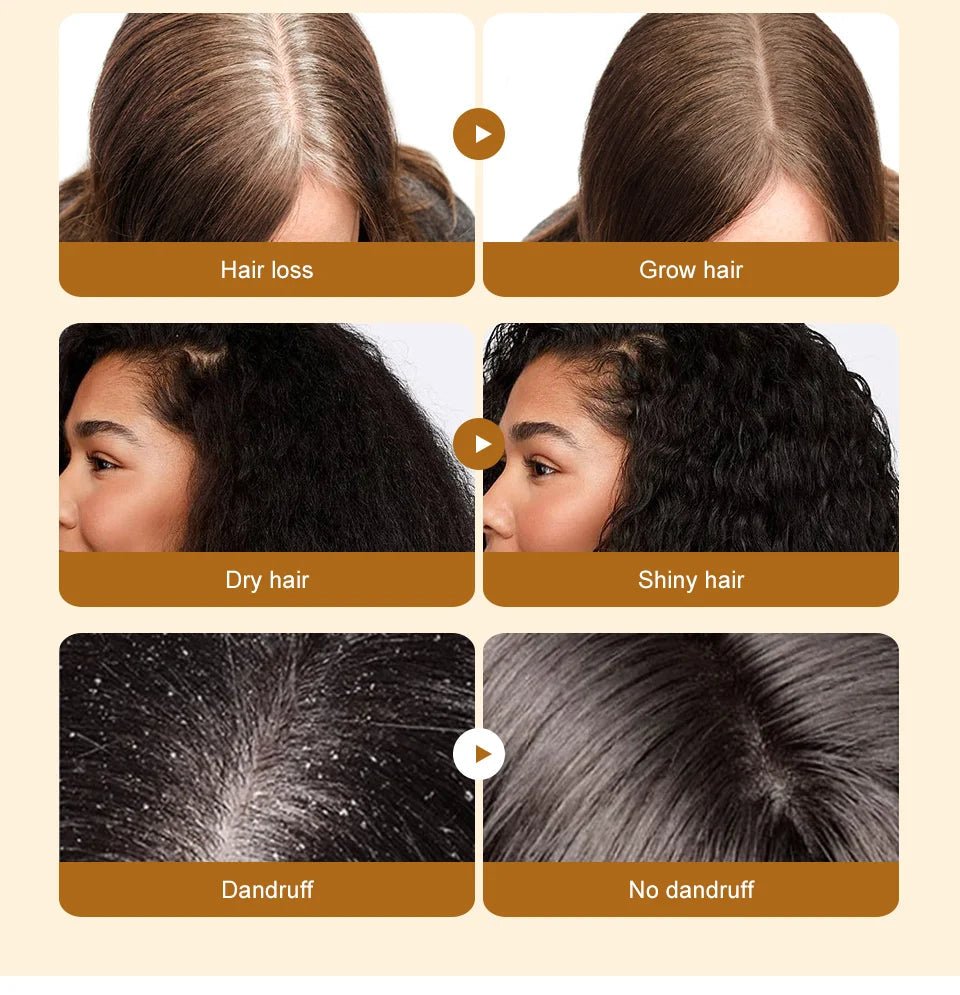 Lewedo Naturals Batana Oil Fast Hair Growth for Men Women Pure Batana Oil Nourish Shiny Hair Healthy Hair Care Anti Hair Loss - RELUX.STORE