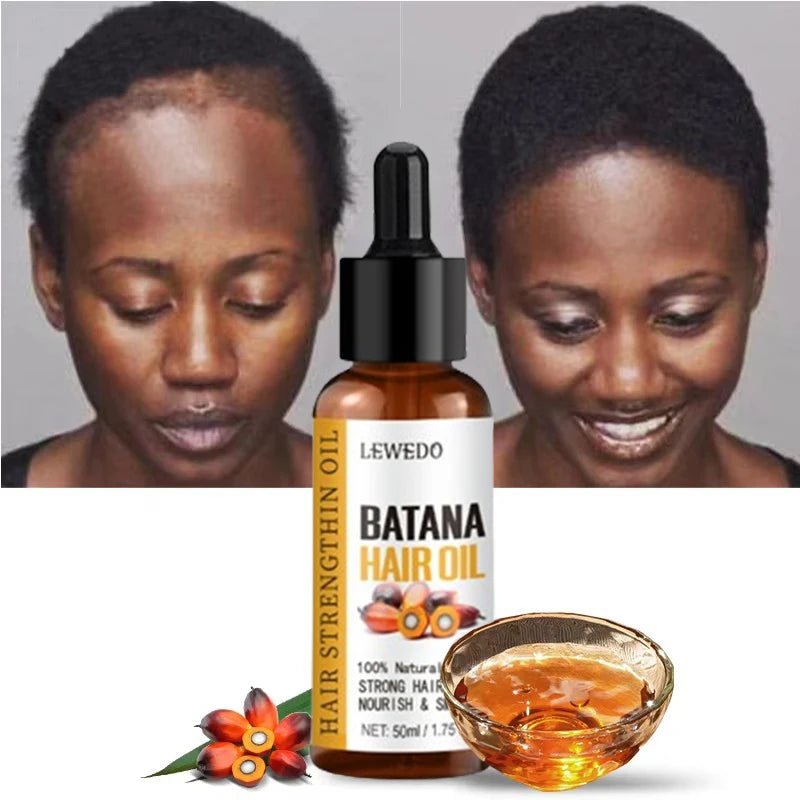 Lewedo Naturals Batana Oil Fast Hair Growth for Men Women Pure Batana Oil Nourish Shiny Hair Healthy Hair Care Anti Hair Loss - RELUX.STORE