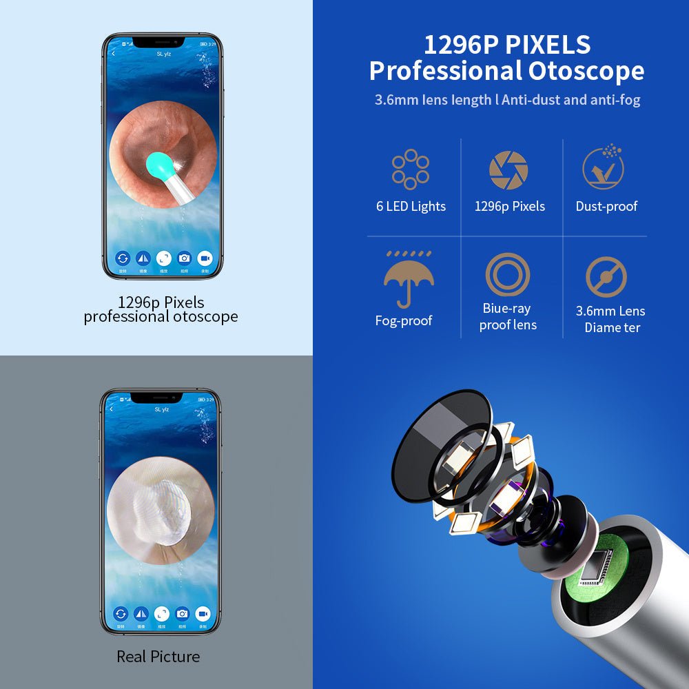 "NE3 Wireless Ear Cleaner Otoscope with Camera & LED Light – Smart Ear Wax Removal Endoscope Kit for iPhone & Android" - RELUX.STORE