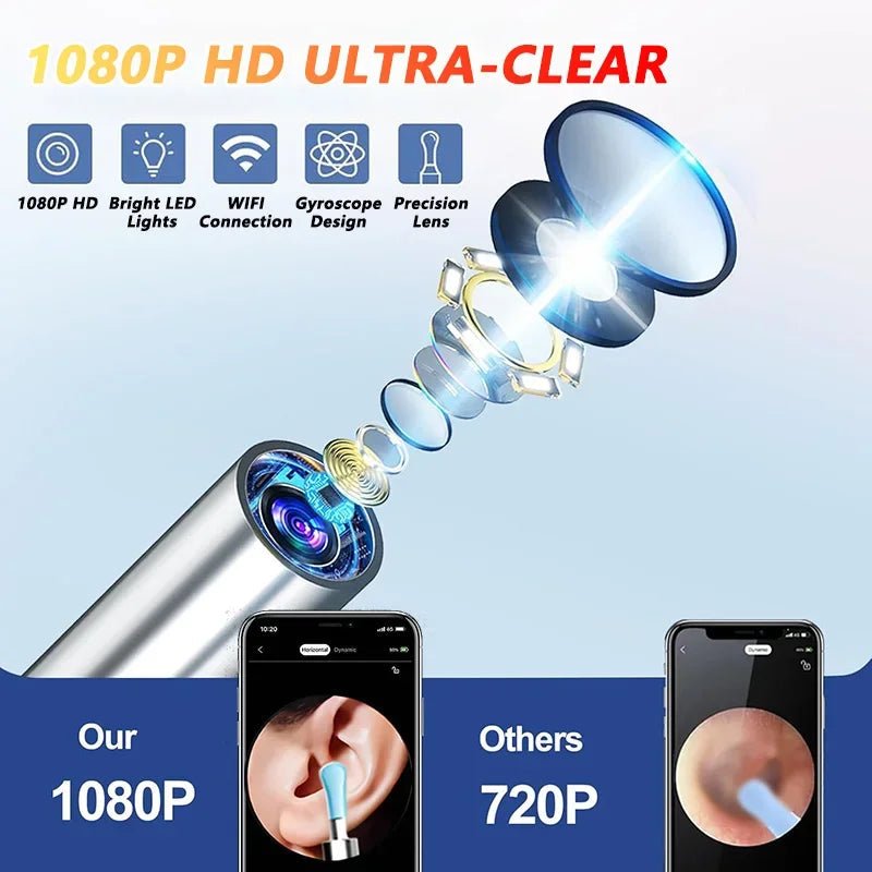 "Visual Ear Wax Cleaner with Camera – Safe Earwax Removal Endoscope, 5M Luminous Otoscope for Ear Cleaning & Care" - RELUX.STORE