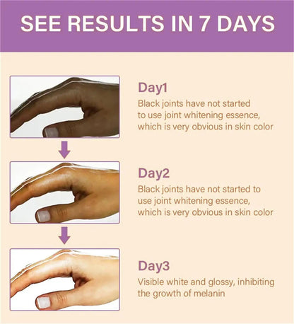 Fast Whitening Dark Knuckles Brighten Hand Cream Melanin Corrector Moisturizing Intense Stains Remover Products Skin Care RELUX.STORE
