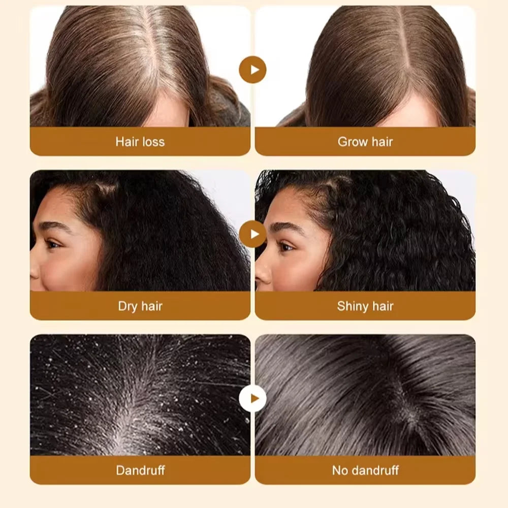 Fast Hair Growth Set Batana Oil Traction Alopecia Hair Mask Anti Break Loss Hair Growth Oil Baldness Treatment Hair Health Care