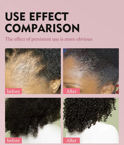 Fast Hair Growth Set Batana Oil Traction Alopecia Hair Mask Anti Break Loss Hair Growth Oil Baldness Treatment Hair Health Care