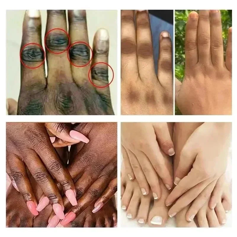 Fast Whitening Dark Knuckles Brighten Hand Cream Melanin Corrector Moisturizing Intense Stains Remover Products Skin Care RELUX.STORE