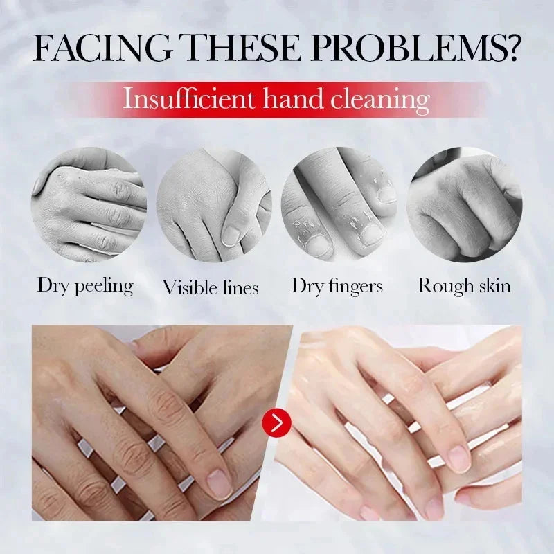 Fast Whitening Dark Knuckles Brighten Hand Cream Melanin Corrector Moisturizing Intense Stains Remover Products Skin Care RELUX.STORE