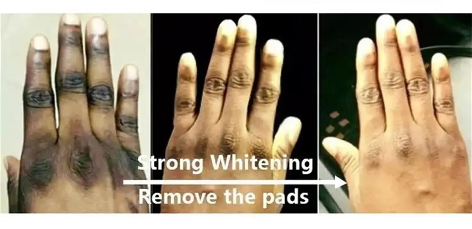 Fast Whitening Dark Knuckles Brighten Hand Cream Melanin Corrector Moisturizing Intense Stains Remover Products Skin Care RELUX.STORE