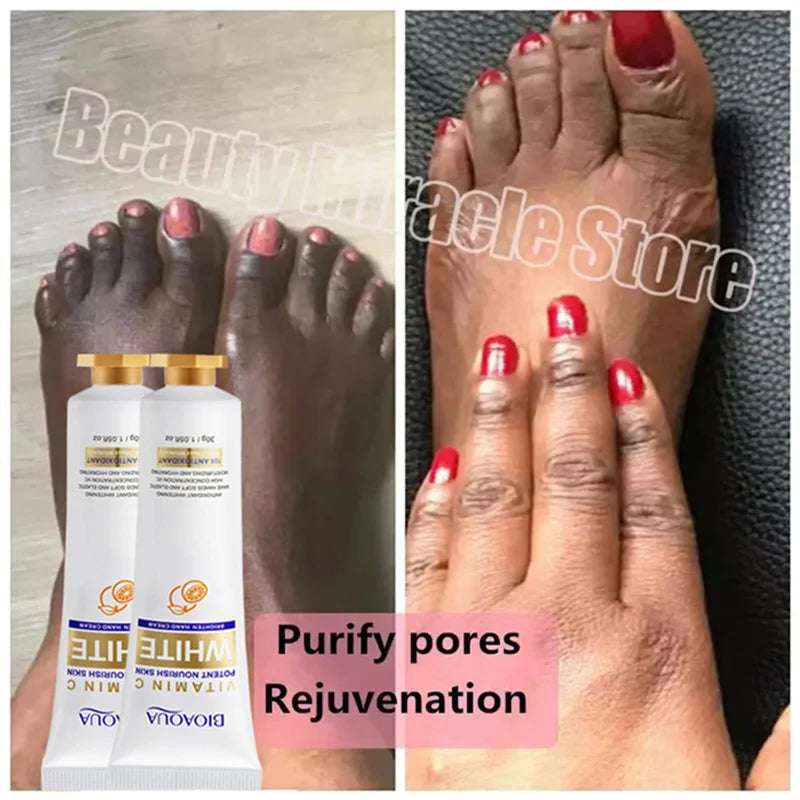 Fast Whitening Dark Knuckles Brighten Hand Cream Melanin Corrector Moisturizing Intense Stains Remover Products Skin Care RELUX.STORE