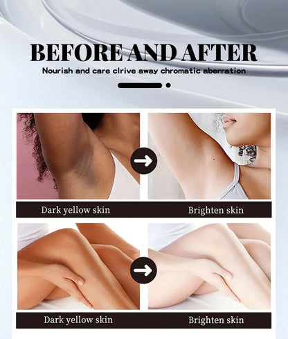 MEDIAN Radiance Cream For Body Brightening Elbows Knees Underarms Dark Spot Corrector Vitamin C Moisturizing Korean Skincare RELUX.STORE