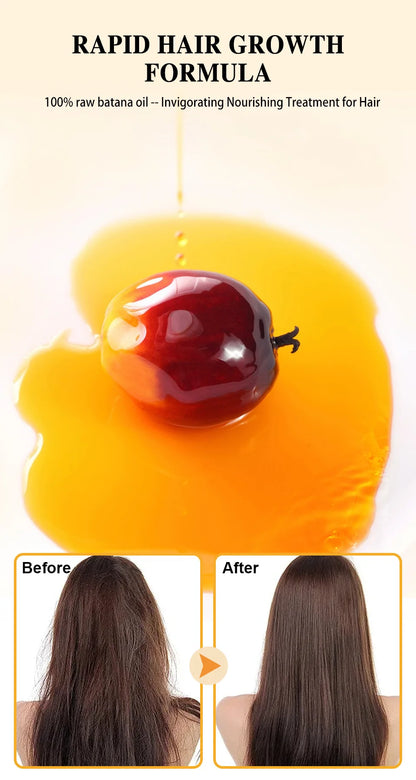 Fast Hair Growth Set Batana Oil Traction Alopecia Hair Mask Anti Break Loss Hair Growth Oil Baldness Treatment Hair Health Care
