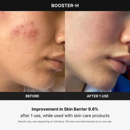 Age - R Booster Healer – Korean Facial Treatment Device for Deep Hydration, Skin Rejuvenation & Natural Glow - RELUX.STORE