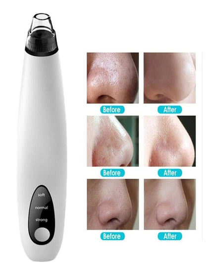 “Electric Blackhead Remover Vacuum – Diamond Microdermabrasion Face Cleaner for Pore & Whitehead Extraction | Professional Suction Facial Tool” - RELUX.STORE