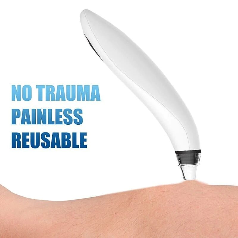 “Electric Blackhead Remover Vacuum – Diamond Microdermabrasion Face Cleaner for Pore & Whitehead Extraction | Professional Suction Facial Tool” - RELUX.STORE