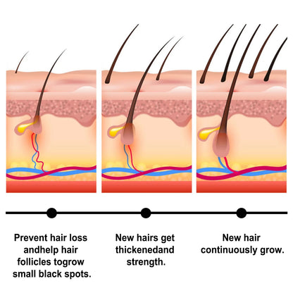 Fast Hair Growth Set Batana Oil Traction Alopecia Hair Mask Anti Break Loss Hair Growth Oil Baldness Treatment Hair Health Care - RELUX.STORE