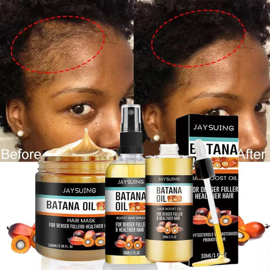 Fast Hair Growth Set Batana Oil Traction Alopecia Hair Mask Anti Break Loss Hair Growth Oil Baldness Treatment Hair Health Care - RELUX.STORE