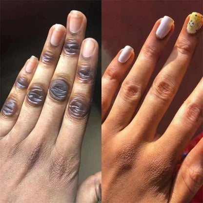 Fast Whitening Dark Knuckles Brighten Hand Cream Melanin Corrector Moisturizing Intense Stains Remover Products Skin Care - RELUX.STORE