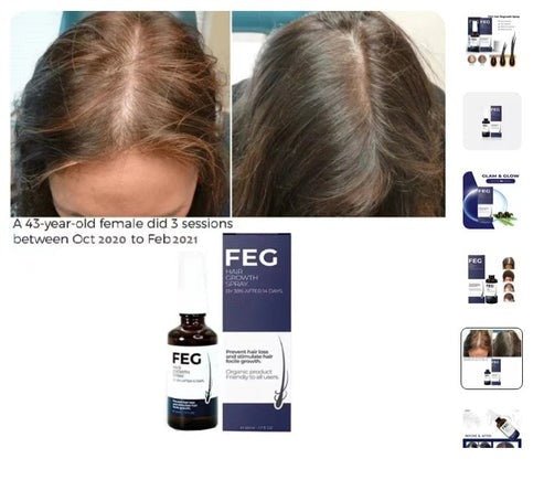 FEG Hair Growth Spray - RELUX.STORE