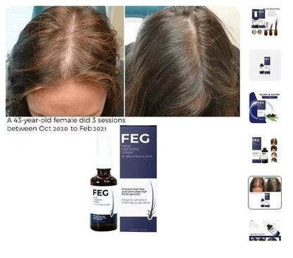 FEG Hair Growth Spray - RELUX.STORE