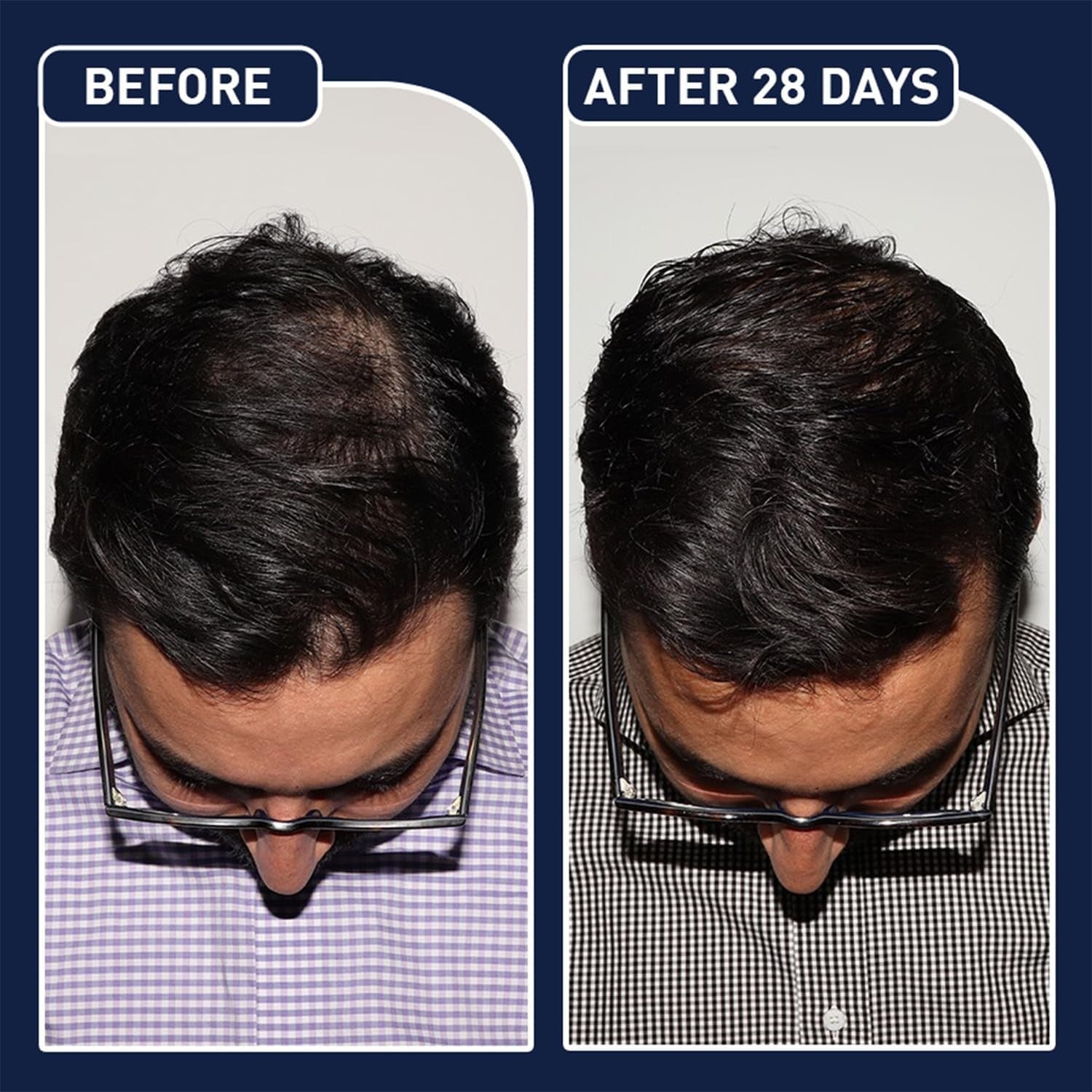 FEGPlus Minoxidil Beard & Hair Growth Serum - RELUX.STORE