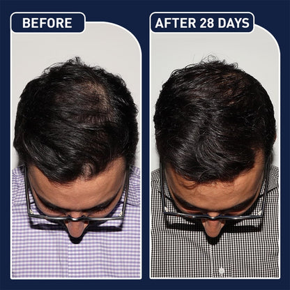 FEGPlus Minoxidil Beard & Hair Growth Serum - RELUX.STORE