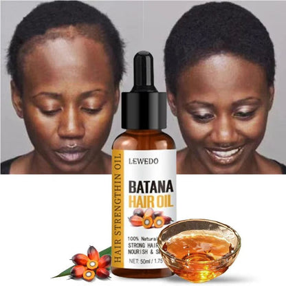 Lewedo Naturals Batana Oil Fast Hair Growth for Men Women Pure Batana Oil Nourish Shiny Hair Healthy Hair Care Anti Hair Loss - RELUX.STORE