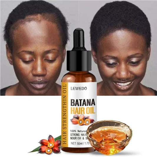 Lewedo Naturals Batana Oil Fast Hair Growth for Men Women Pure Batana Oil Nourish Shiny Hair Healthy Hair Care Anti Hair Loss - RELUX.STORE