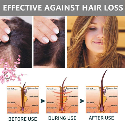 Sakura Japanese Shampoo For Hair Loss - RELUX.STORE