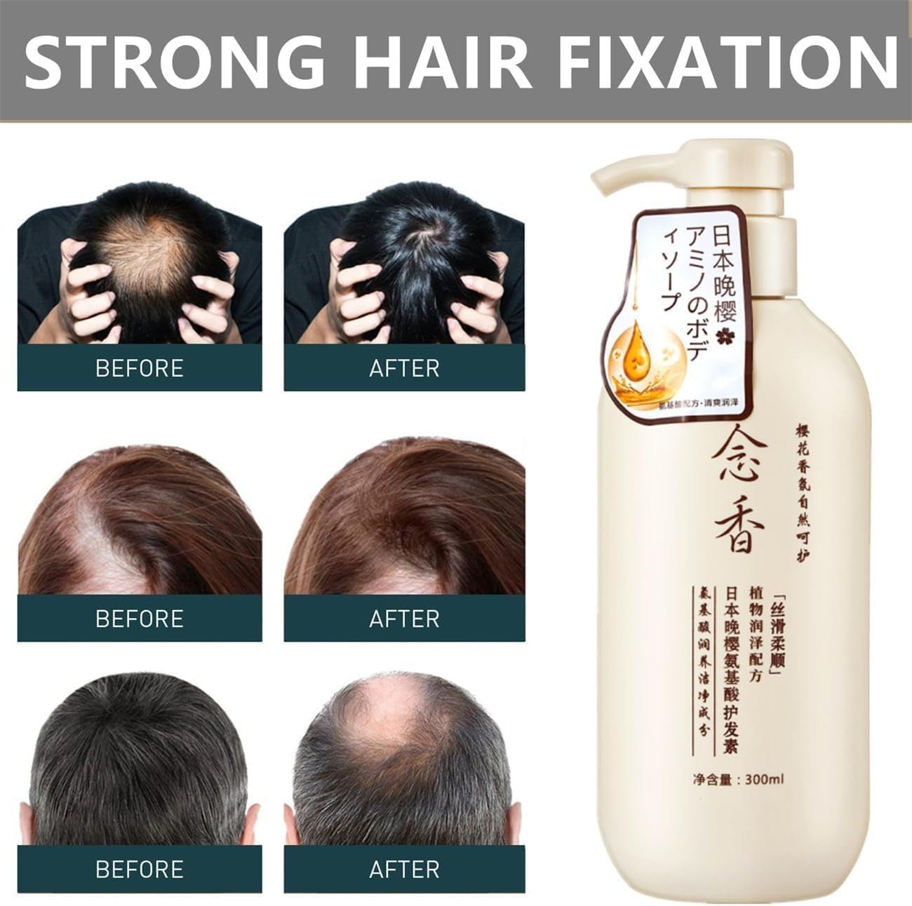 Sakura Japanese Shampoo For Hair Loss - RELUX.STORE