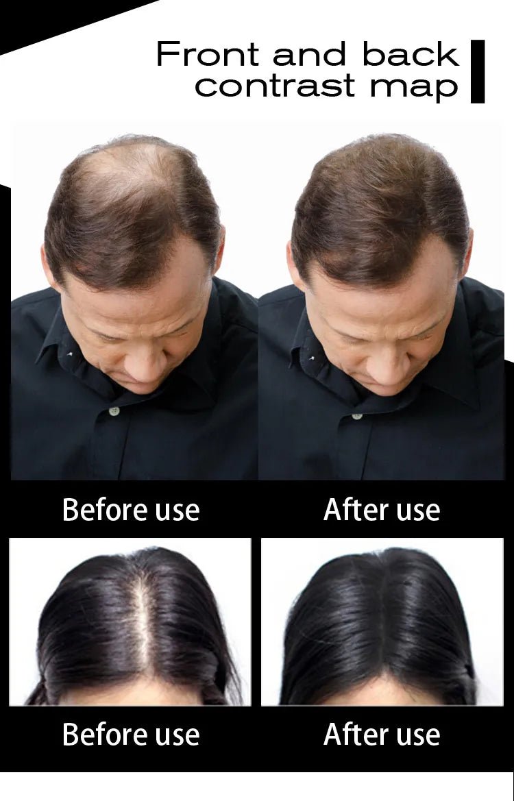 Sevich 100g 10 Color Keratin Hair Loss Building Fiber Hair Growth Fiber Refill Hair Loss Concealer Blender 50g Hair Care Product - RELUX.STORE