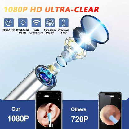 "Visual Ear Wax Cleaner with Camera – Safe Earwax Removal Endoscope, 5M Luminous Otoscope for Ear Cleaning & Care" - RELUX.STORE