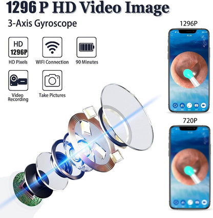 “Waterproof Ear Wax Removal Cleaner Kit – Safe LED Otoscope with Ear Pick & USB Charging for Home & Travel” - RELUX.STORE